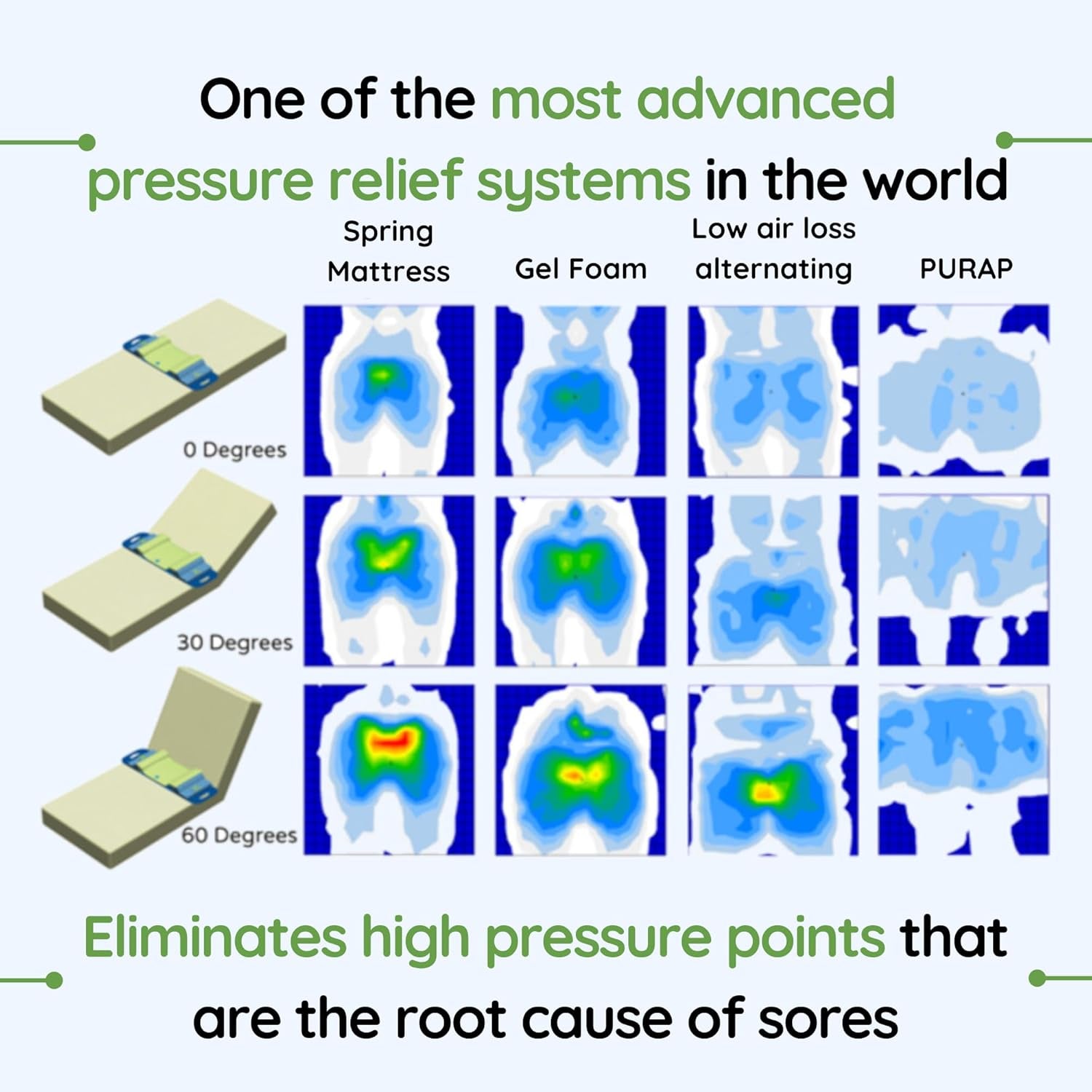 PRS Medical |  Bedsore Mattress Pad - Pressure Sore Prevention & Treatment - Pressure Relief Fluid 3D Flotation Technology - 38 X 12 X 3 Inches