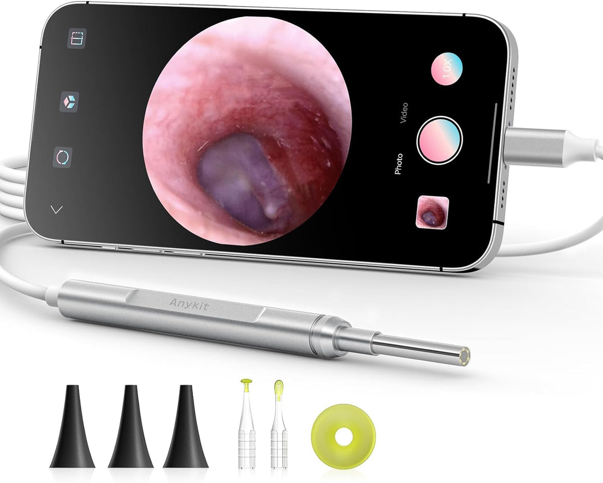 Digital Otoscope for Phone D & Tablet, Ultra Clear View Ear Camera with Ear Wax Removal Tools, Video Ear Scope Otoscope with Light, Support Capture Photo & Record Videos