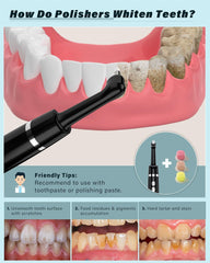 Rechargeable Tooth Whitening Kit, 1 Kit