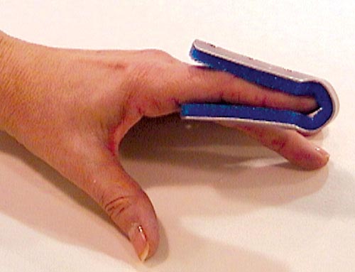 Fold Over Finger Splint Small Bulk  PK/6 Non-Retail
